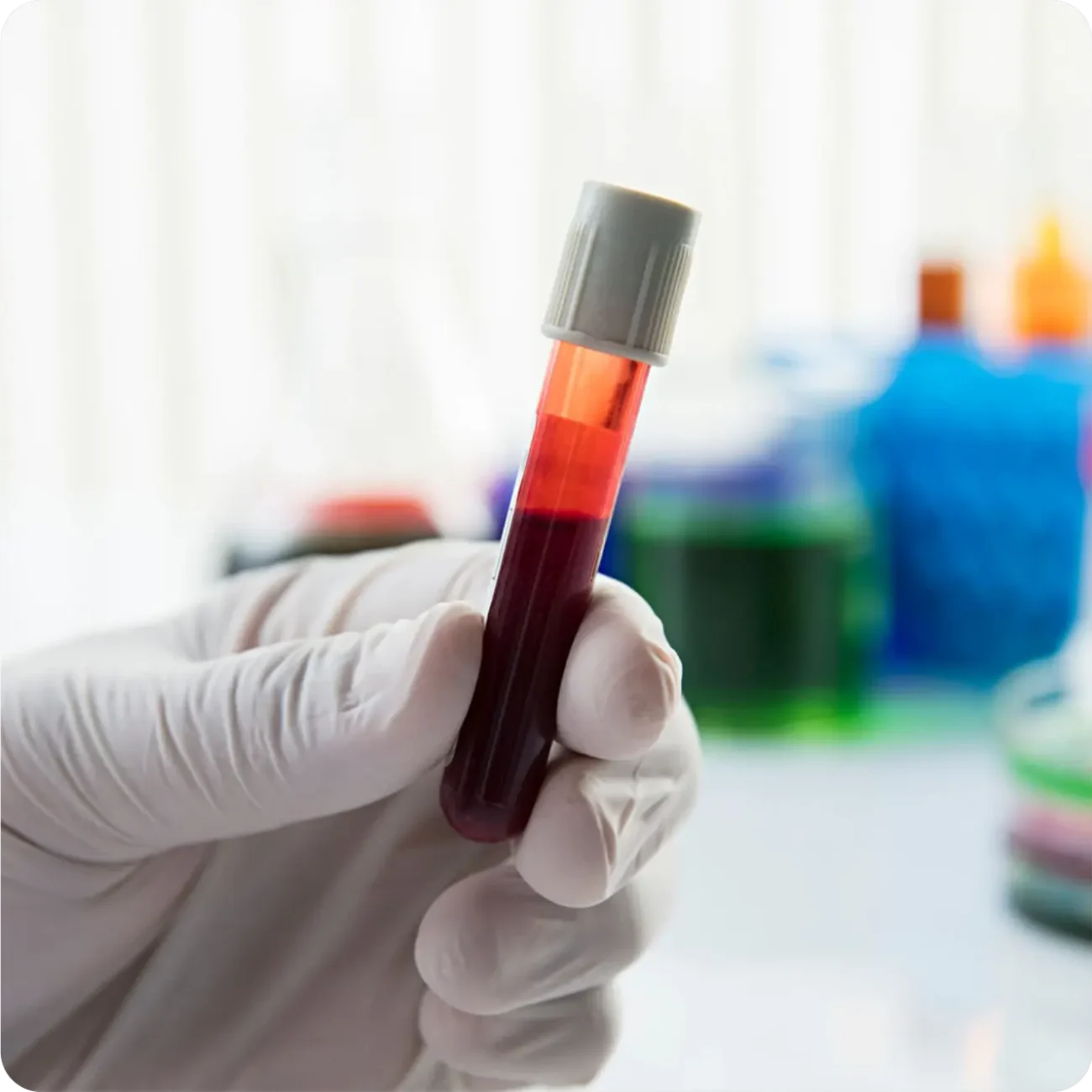 Skip the Lab — We Come to You